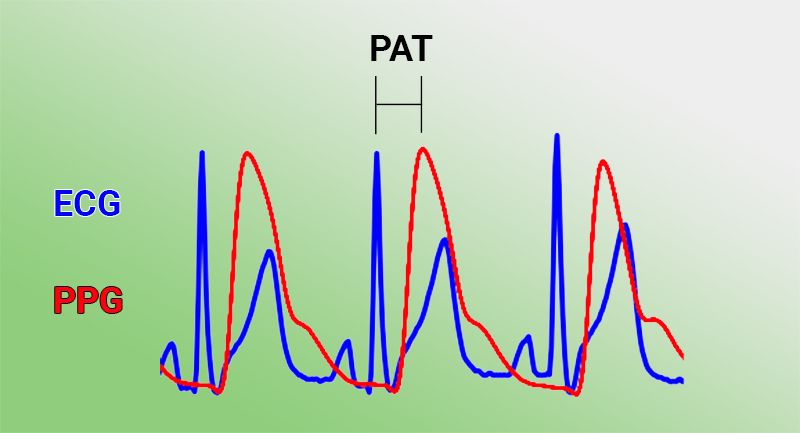 Clarification of the connection of PAT to ECG and PPG