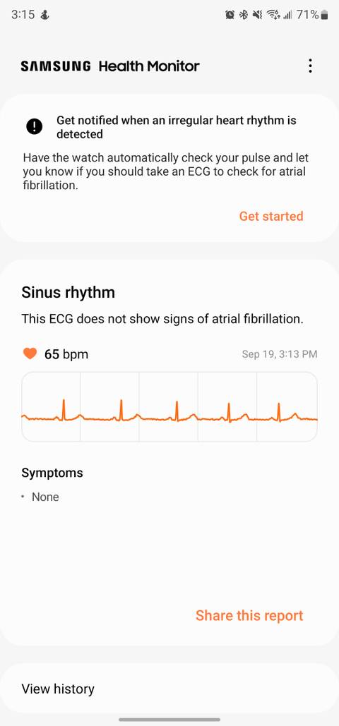 Heart Rate Monitor Ecg In Samsung Watch Ecg Samsung Galaxy Watch