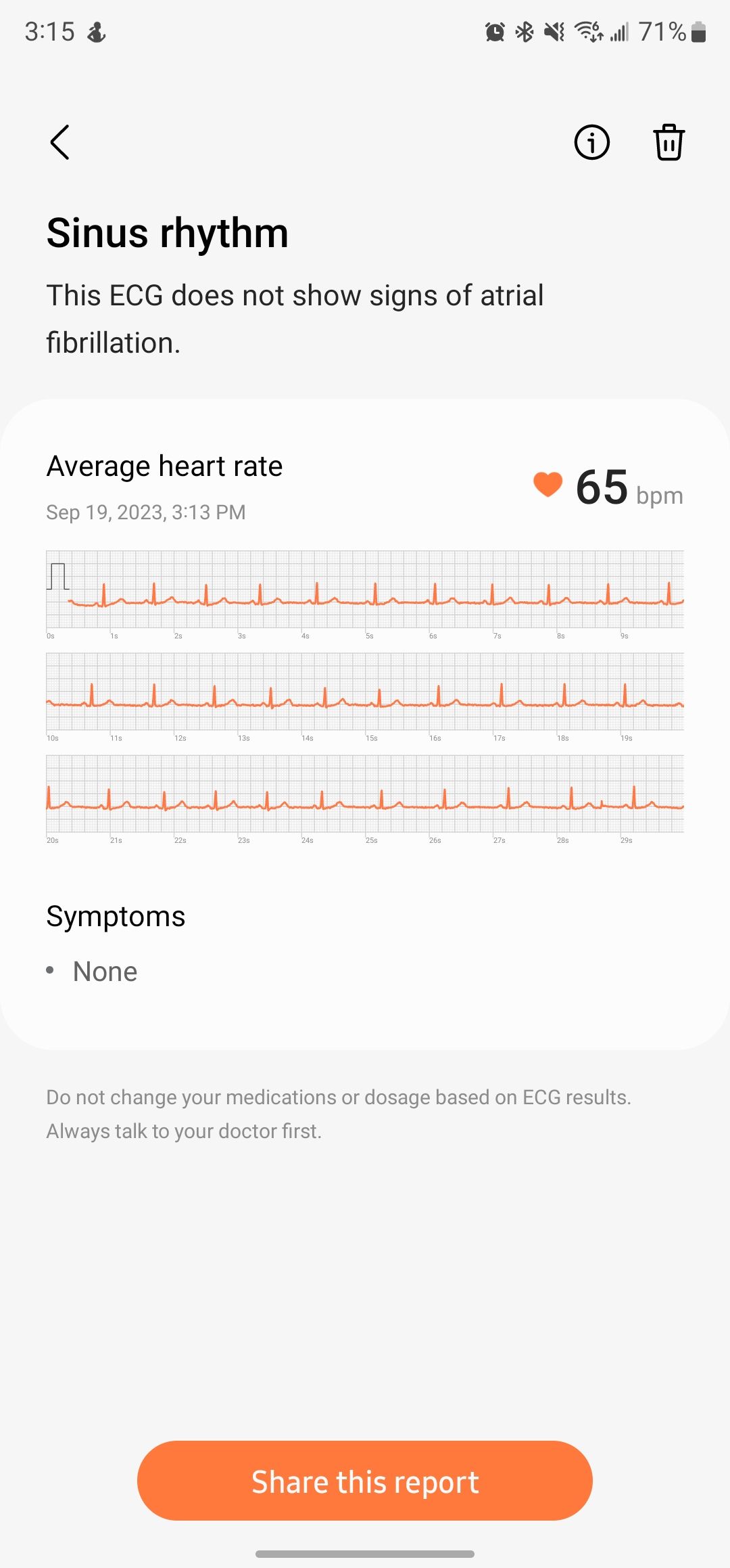 ECG details in the Samsung Health Monitor mobile app.