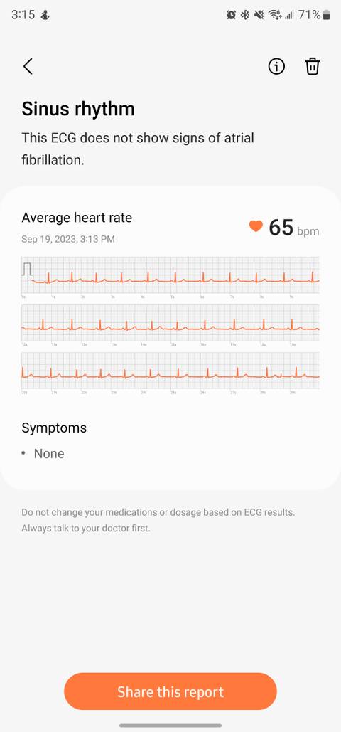 Heart Rate Monitor Ecg In Samsung Watch Ecg Samsung Fit Heart Rate