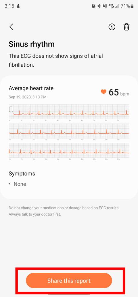 Ekg Galaxy Watch Health App Monitor App Samsung Health Ekg Ecg App