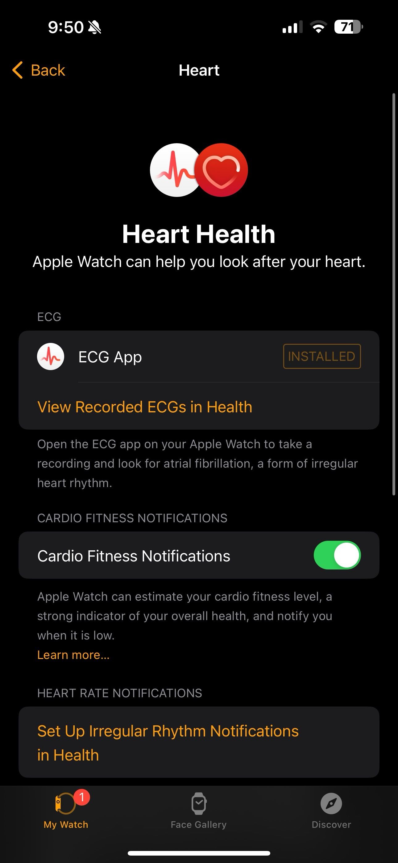 ECG installed on Apple Watch