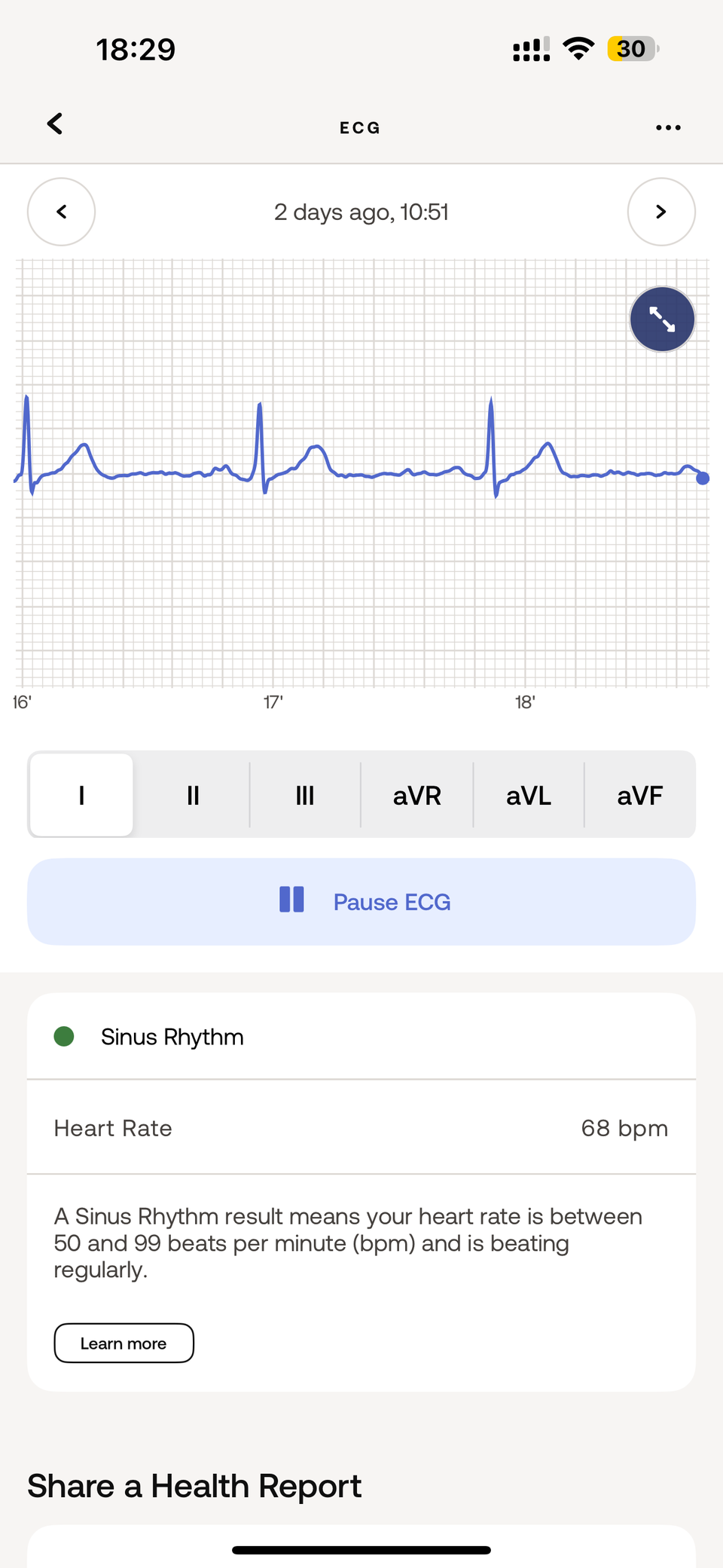 Withings-body-snp4