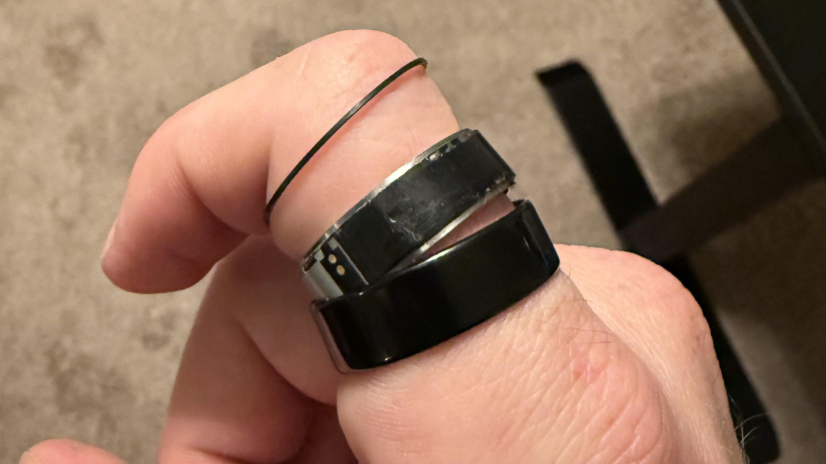A broken Oura Ring 4 on a user's finger.